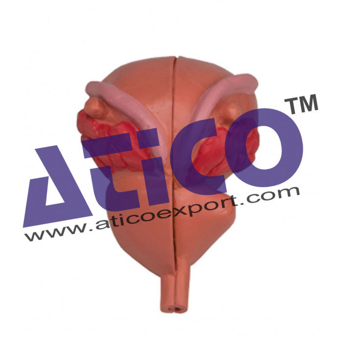 Male Urinary Bladder With Prostate - 2 Parts