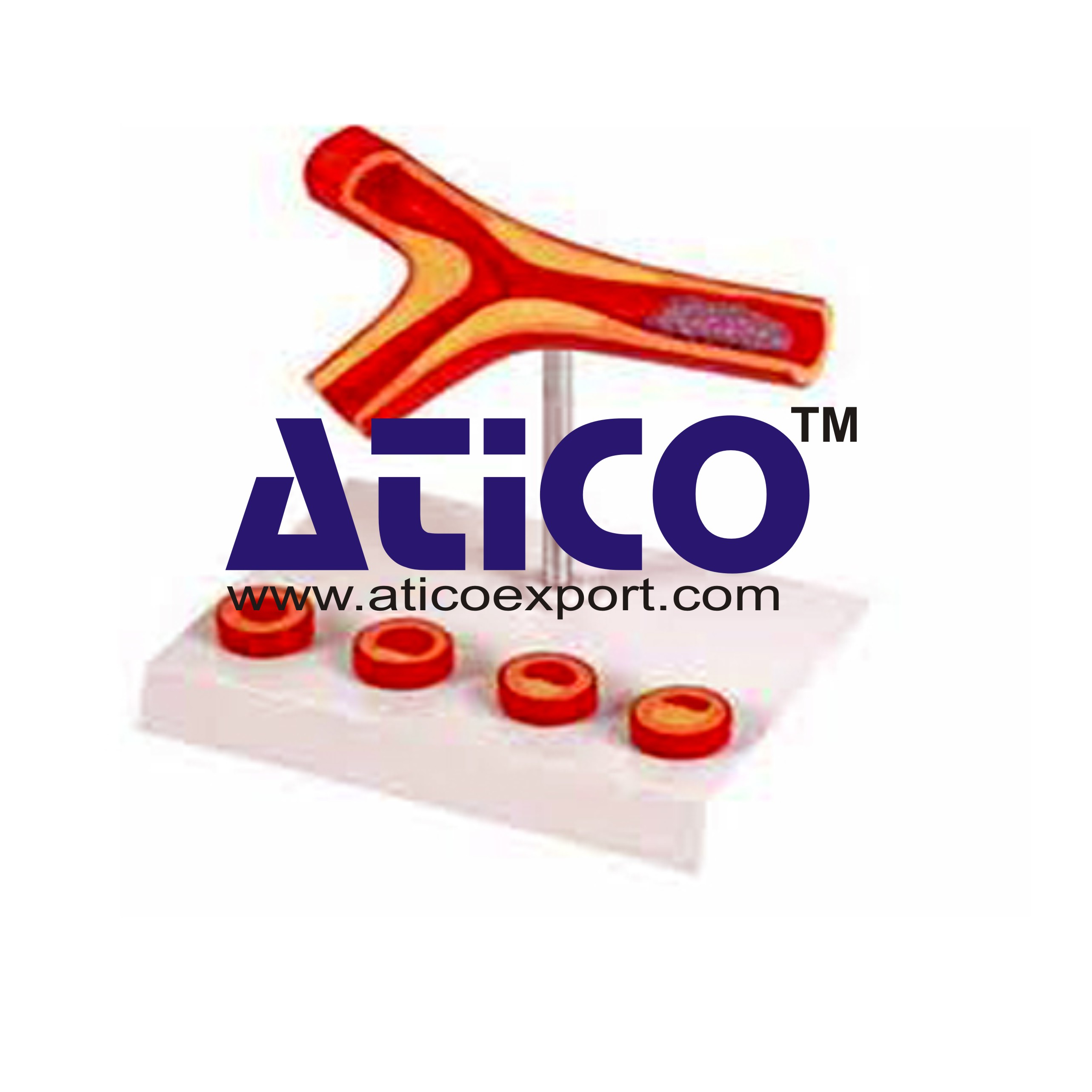 Atherosclerosis And Thrombosis Model