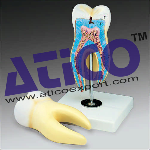 Right Lower First Molar
