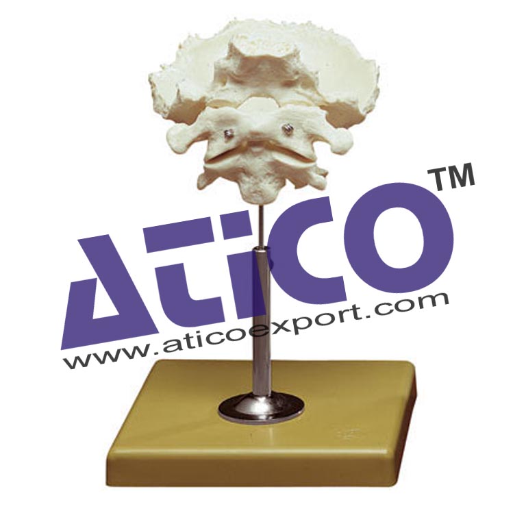 Atlas Axis And Occipital Bone Model