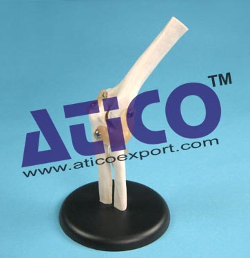 Elbow Joint Models