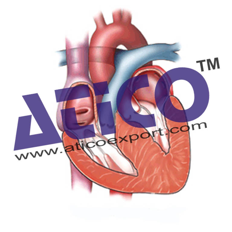 Heart Hypertrophy Model