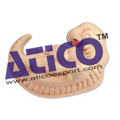 Human Embryo 4-Week Old