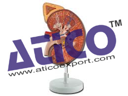 Kidney with Adrenal Gland 1-5 Times Enlarged - 2 Parts