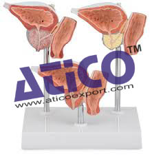 Normal And Diseased Prostate Gland