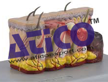 Pathological Model Of Burned Skin