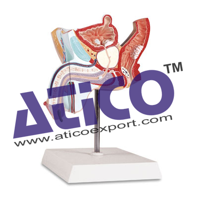 Pathological Model Of The Male Urogenital System