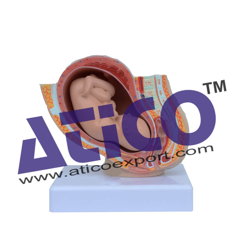 Pregnancy Pelvis With Mature Fetus